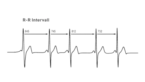 EKG-Graph in schwarz auf transparentem Hintergrund